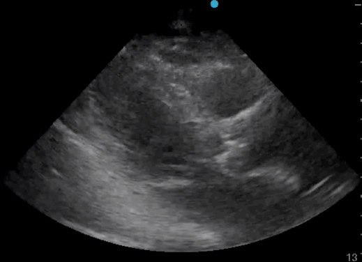 EEU case image missing